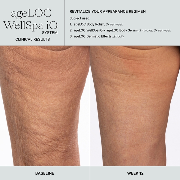 WellSpa iO before after 3min 3x tigh-600x600-bc87582